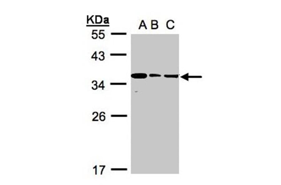 bisphosphoglycerate mutase antibody from Signalway Antibody (22970) - Antibodies.com
