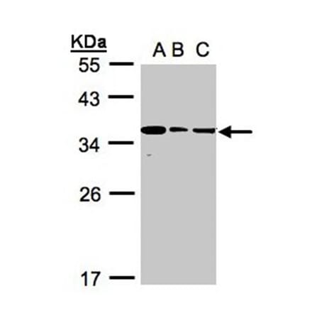 bisphosphoglycerate mutase antibody from Signalway Antibody (22970) - Antibodies.com