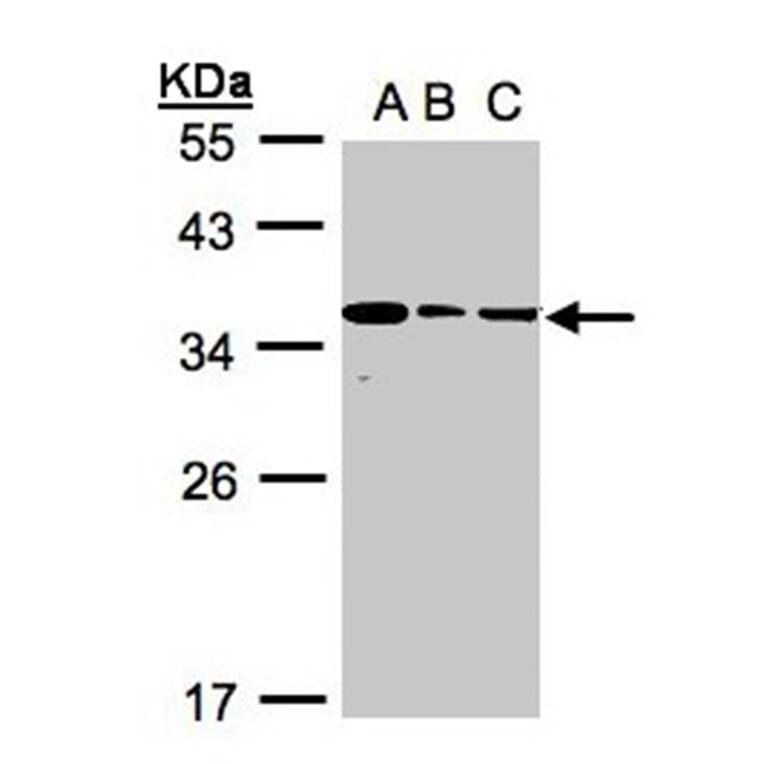 bisphosphoglycerate mutase antibody from Signalway Antibody (22970) - Antibodies.com