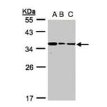 bisphosphoglycerate mutase antibody from Signalway Antibody (22970) - Antibodies.com