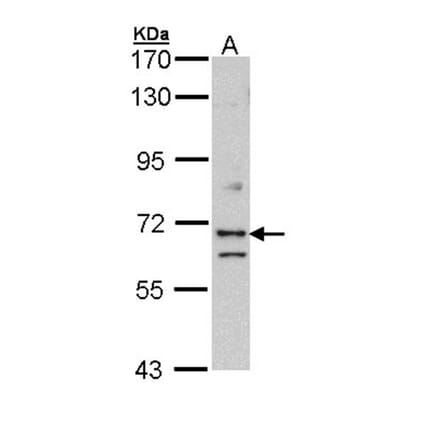 EXOC7 antibody from Signalway Antibody (22034) - Antibodies.com