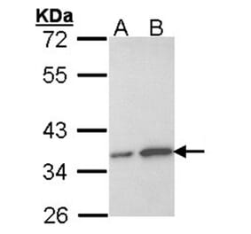 OTUB1 antibody from Signalway Antibody (22056) - Antibodies.com
