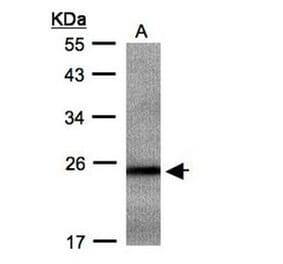RAB2B antibody from Signalway Antibody (22077) - Antibodies.com
