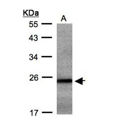 RAB2B antibody from Signalway Antibody (22077) - Antibodies.com