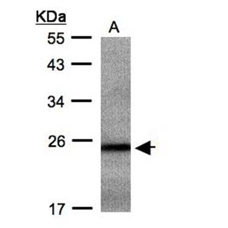 RAB2B antibody from Signalway Antibody (22077) - Antibodies.com
