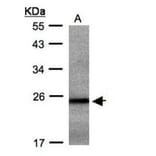 RAB2B antibody from Signalway Antibody (22077) - Antibodies.com