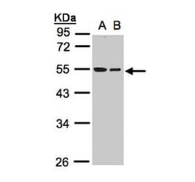 TUBB1 antibody from Signalway Antibody (22114) - Antibodies.com