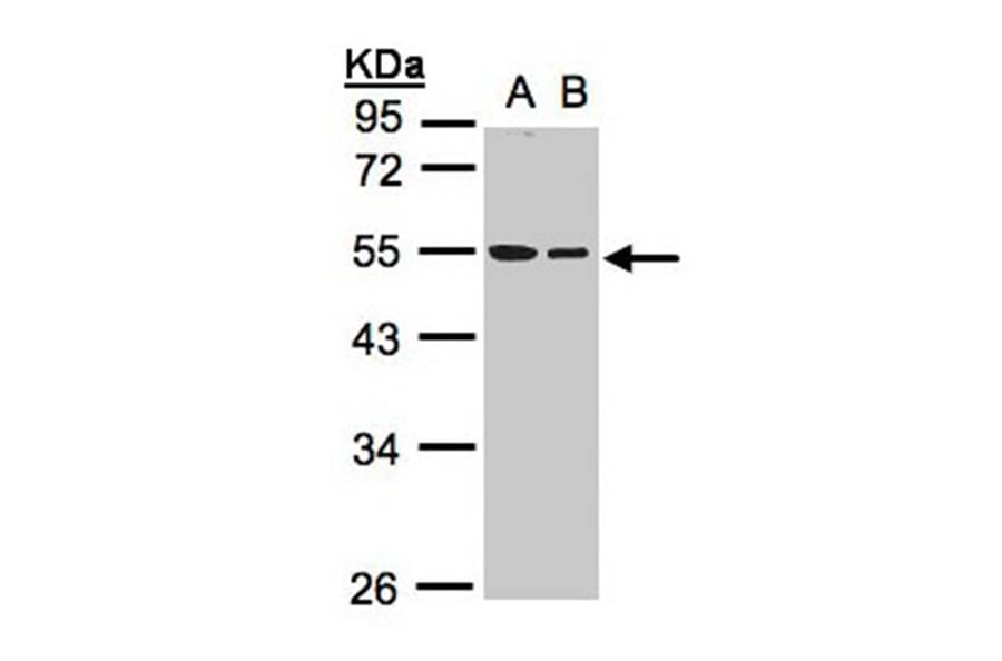 TUBB1 antibody from Signalway Antibody (22114) - Antibodies.com