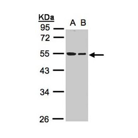 TUBB1 antibody from Signalway Antibody (22114) - Antibodies.com