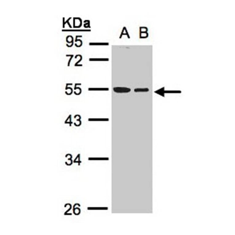 TUBB1 antibody from Signalway Antibody (22114) - Antibodies.com