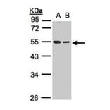 TUBB1 antibody from Signalway Antibody (22114) - Antibodies.com