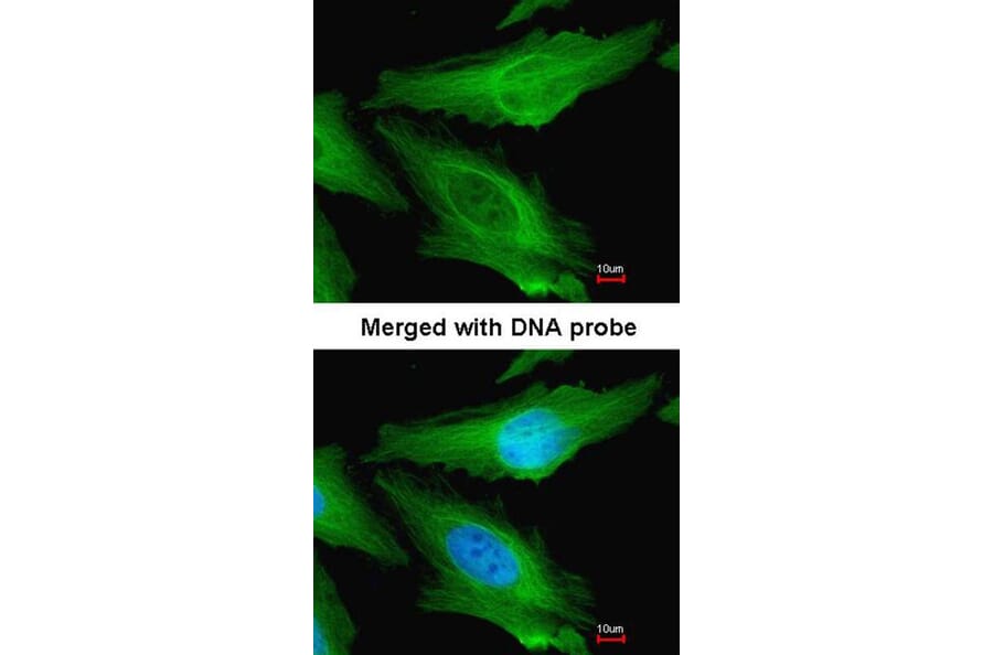 Immunofluorescence - TUBB1 antibody from Signalway Antibody (22114) - Antibodies.com