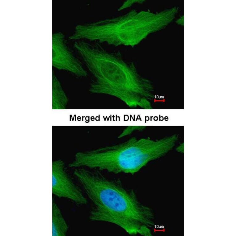 Immunofluorescence - TUBB1 antibody from Signalway Antibody (22114) - Antibodies.com