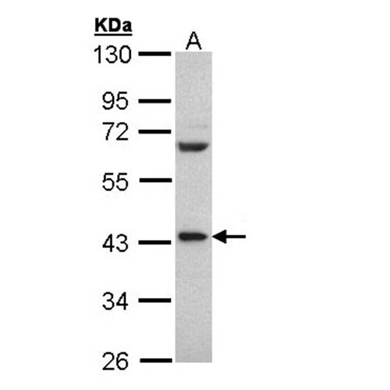PCBP2 antibody from Signalway Antibody (22117) - Antibodies.com