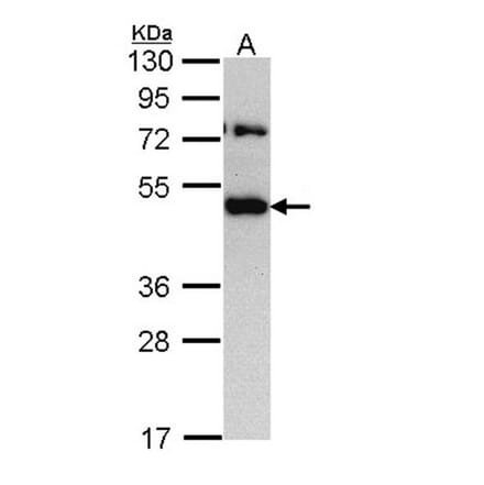 TRAM1 antibody from Signalway Antibody (22159) - Antibodies.com