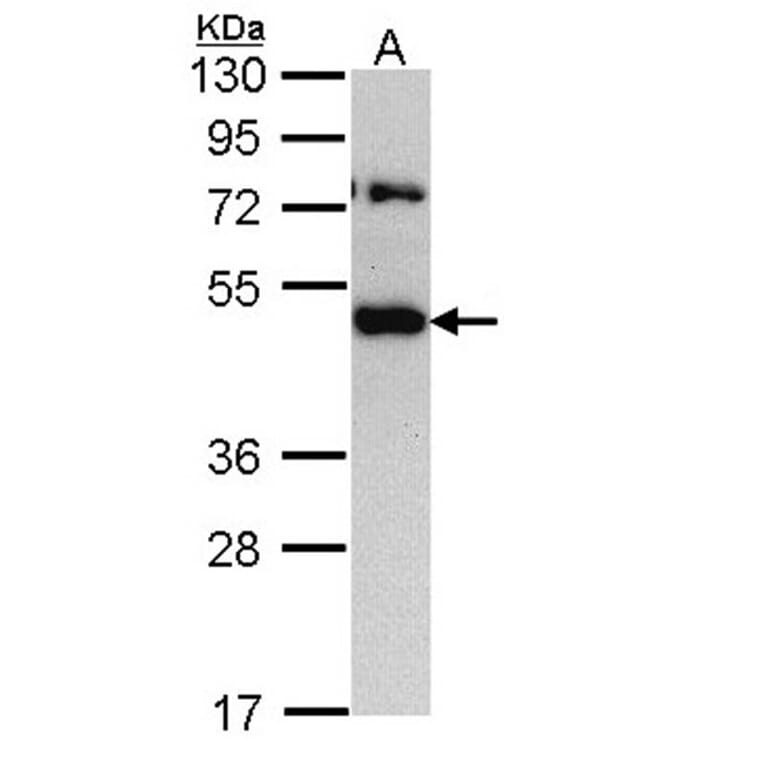 TRAM1 antibody from Signalway Antibody (22159) - Antibodies.com