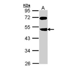 FBXL3 antibody from Signalway Antibody (22365) - Antibodies.com