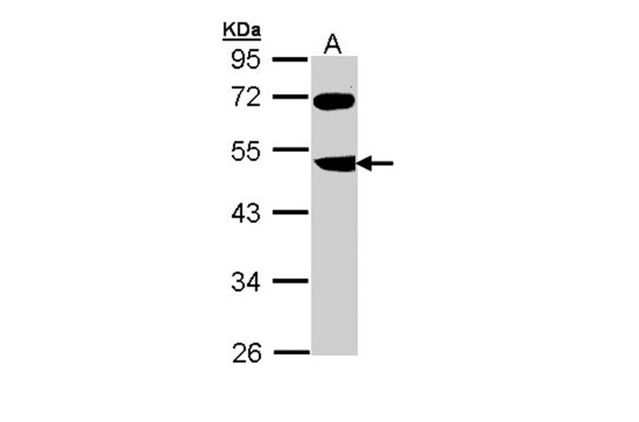 FBXL3 antibody from Signalway Antibody (22365) - Antibodies.com