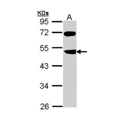 FBXL3 antibody from Signalway Antibody (22365) - Antibodies.com