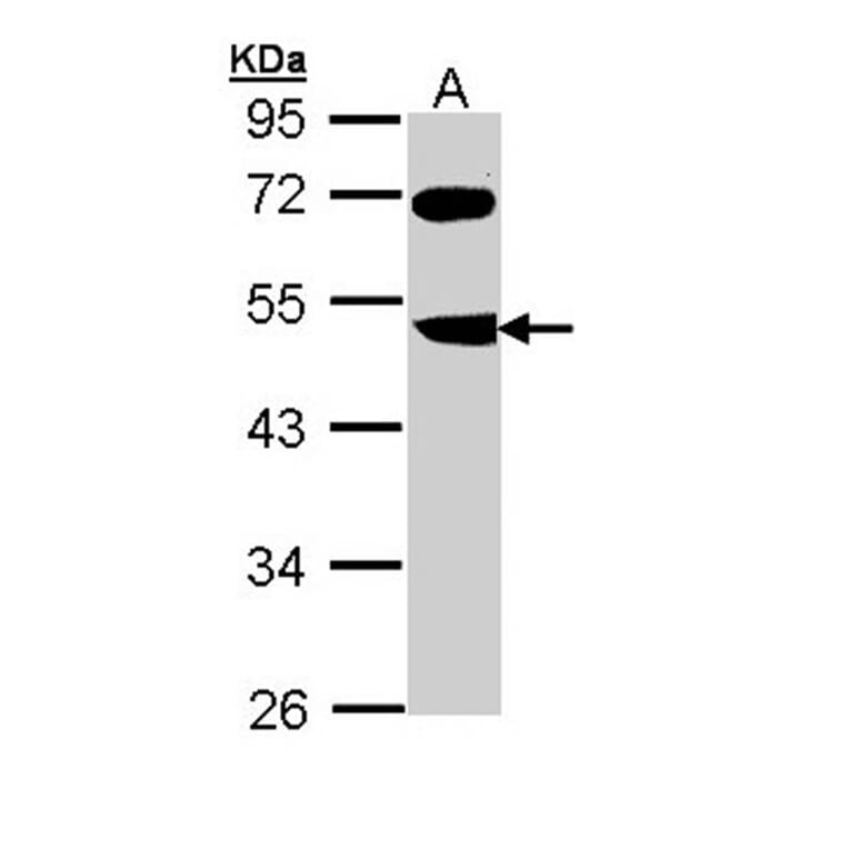 FBXL3 antibody from Signalway Antibody (22365) - Antibodies.com