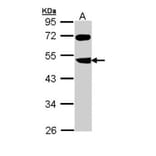 FBXL3 antibody from Signalway Antibody (22365) - Antibodies.com