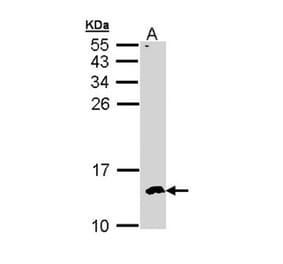 CKS-2 antibody from Signalway Antibody (22374) - Antibodies.com