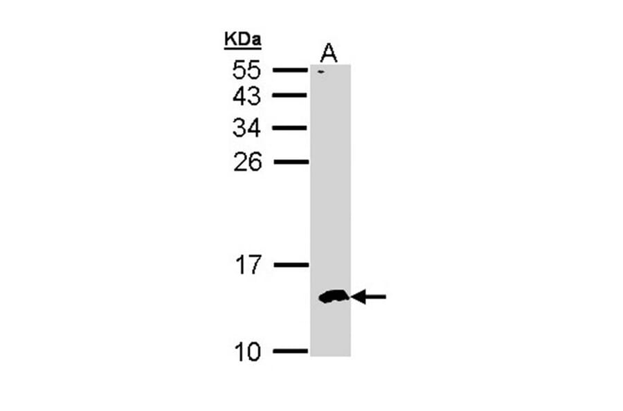 CKS-2 antibody from Signalway Antibody (22374) - Antibodies.com