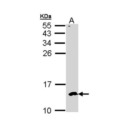 CKS-2 antibody from Signalway Antibody (22374) - Antibodies.com