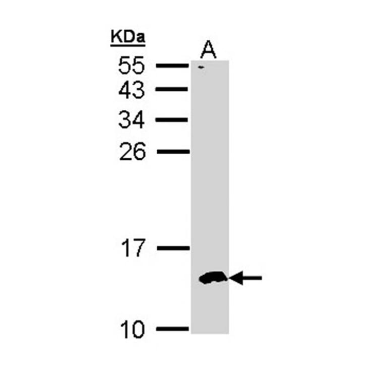 CKS-2 antibody from Signalway Antibody (22374) - Antibodies.com