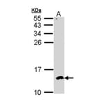 CKS-2 antibody from Signalway Antibody (22374) - Antibodies.com