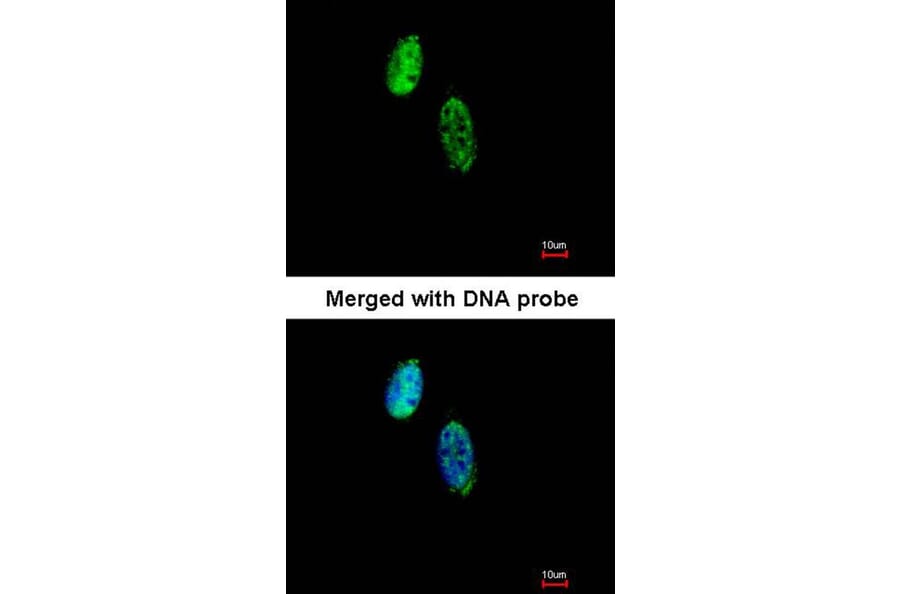 Immunofluorescence - CKS-2 antibody from Signalway Antibody (22374) - Antibodies.com