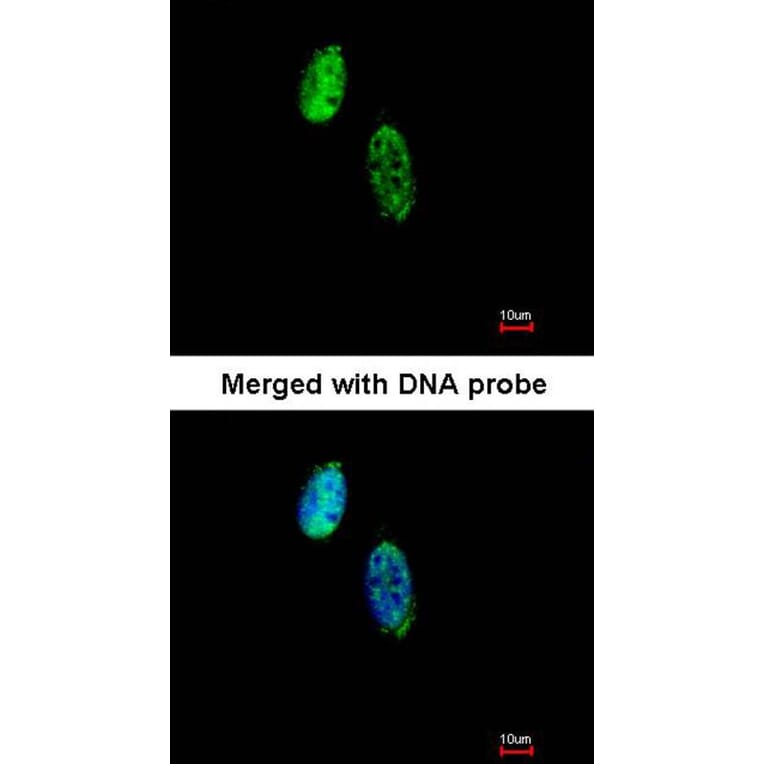 Immunofluorescence - CKS-2 antibody from Signalway Antibody (22374) - Antibodies.com