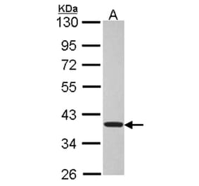 TSSC1 antibody from Signalway Antibody (22379) - Antibodies.com