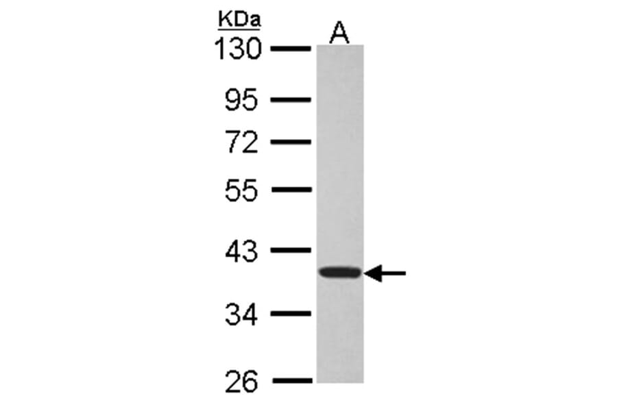 TSSC1 antibody from Signalway Antibody (22379) - Antibodies.com