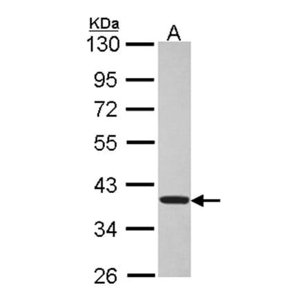 TSSC1 antibody from Signalway Antibody (22379) - Antibodies.com