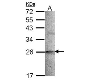 STMN2 antibody from Signalway Antibody (22425) - Antibodies.com