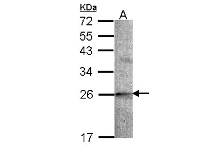 STMN2 antibody from Signalway Antibody (22425) - Antibodies.com