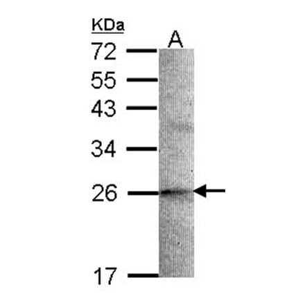 STMN2 antibody from Signalway Antibody (22425) - Antibodies.com