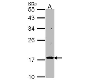 RGS17 antibody from Signalway Antibody (22501) - Antibodies.com