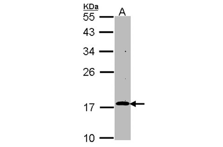 RGS17 antibody from Signalway Antibody (22501) - Antibodies.com