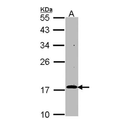 RGS17 antibody from Signalway Antibody (22501) - Antibodies.com