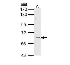 ADCK1 antibody from Signalway Antibody (22538) - Antibodies.com