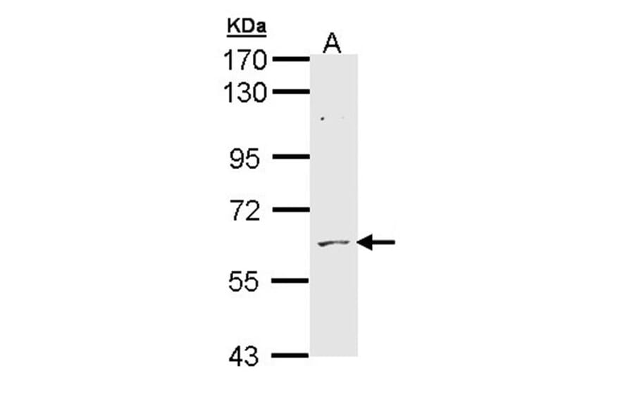 ADCK1 antibody from Signalway Antibody (22538) - Antibodies.com