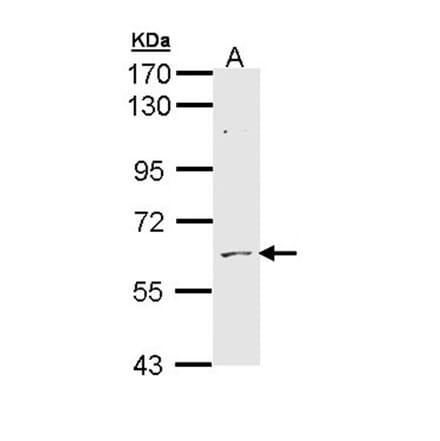 ADCK1 antibody from Signalway Antibody (22538) - Antibodies.com