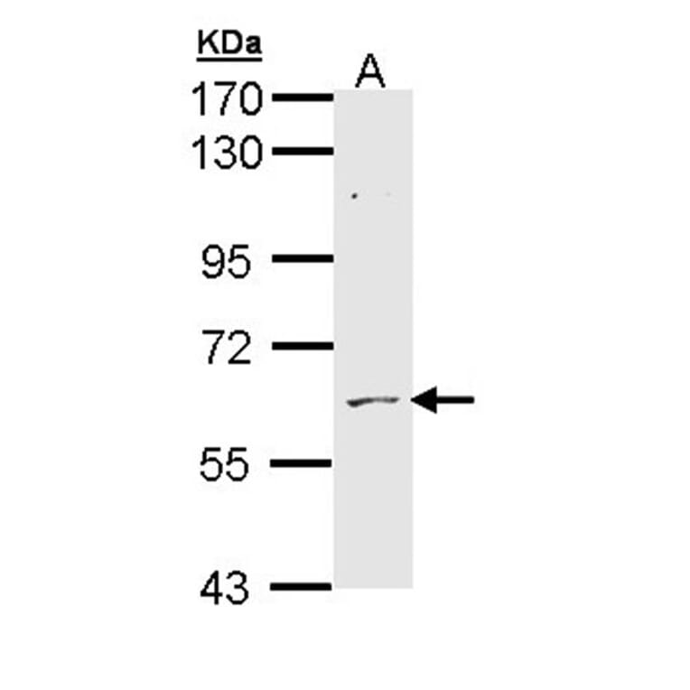 ADCK1 antibody from Signalway Antibody (22538) - Antibodies.com