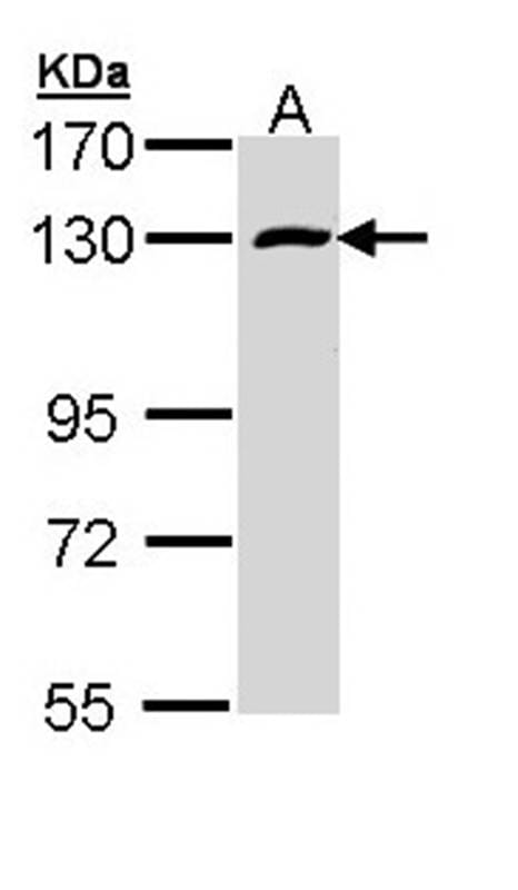 Sample (30 µg of whole cell lysate)  A431 7.5% SDS PAGE Primary antibody diluted at 1: 1000