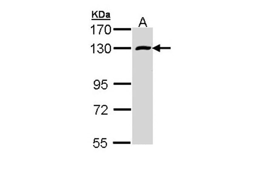 RBM15 antibody from Signalway Antibody (22551) - Antibodies.com