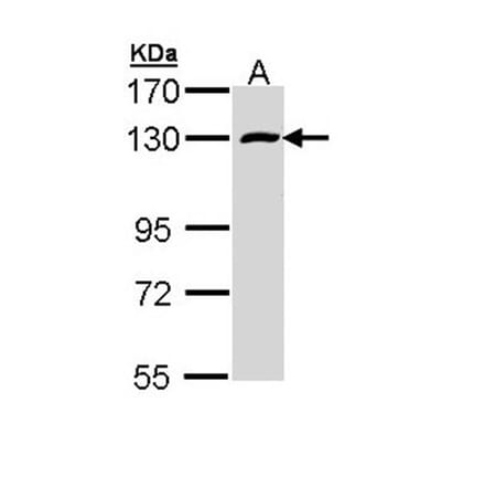 RBM15 antibody from Signalway Antibody (22551) - Antibodies.com