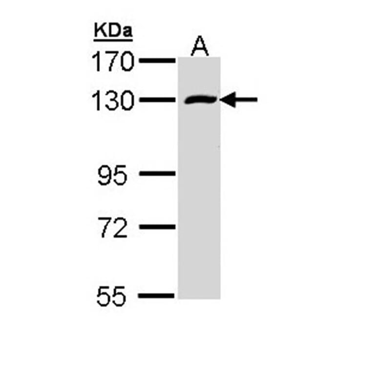 RBM15 antibody from Signalway Antibody (22551) - Antibodies.com