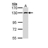 RBM15 antibody from Signalway Antibody (22551) - Antibodies.com